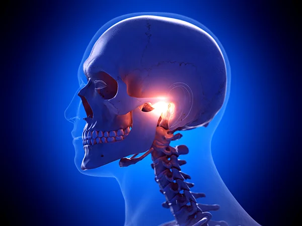 3D rendered xray of a skull with the TMJ highlighted