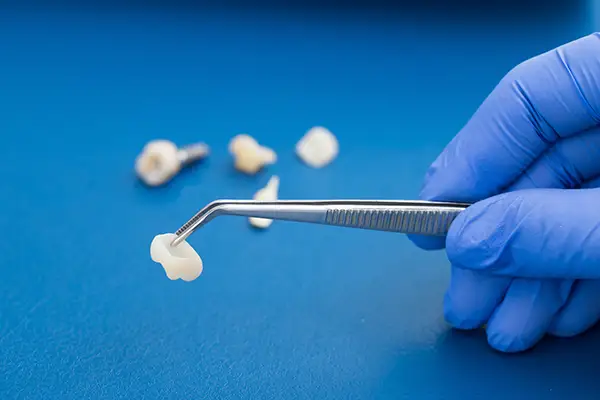 Dental crown held by tweezers with dental tools and a model on a blue background, emphasizing restorative dentistry.